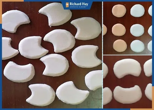 Quy trình phẫu thuật độn thái dương