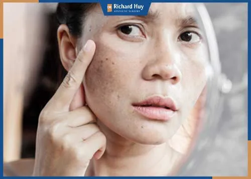 Chia sẻ bí quyết chống lão hóa da tốt Chia sẻ bí quyết chống lão hóa da tốt