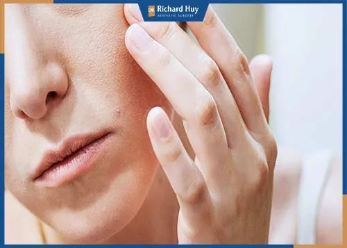 Các cách điều trị lão hóa da mặt Các cách điều trị lão hóa da mặt