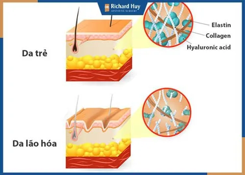 Bước qua độ tuổi 30, khả năng sản sinh collagen bị hạn chế. Bước qua độ tuổi 30, khả năng sản sinh collagen bị hạn chế.