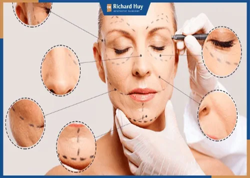 Gây mê tạo cảm giác thoải mái cho khách hàng, đảm bảo cuộc phẫu thuật diễn ra theo đúng quy trình. Gây mê tạo cảm giác thoải mái cho khách hàng, đảm bảo cuộc phẫu thuật diễn ra theo đúng quy trình.