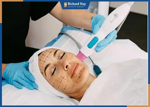 Nâng cơ mặt có nguy hiểm không?