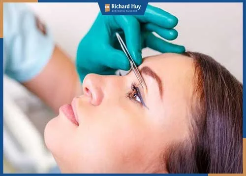 Nhấn mí bằng chỉ sử dụng chỉ gì? Nhấn mí bằng chỉ sử dụng chỉ gì?