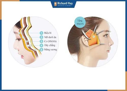 Mô phỏng tiến hành kỹ thuật cắt bỏ lớp da thừa Mô phỏng tiến hành kỹ thuật cắt bỏ lớp da thừa