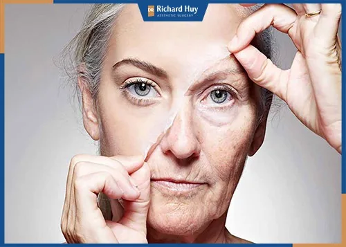 Nâng cơ mặt giúp trẻ hoá làn da một cách hiệu quả