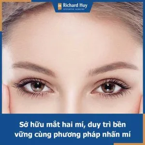Tìm hiểu về phương pháp nhấn mí bằng chỉ cùng Dr. Richard Huy