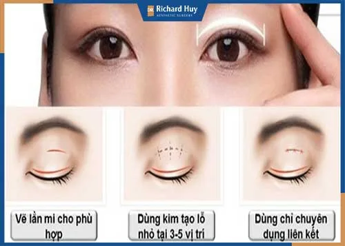 Nhấn mí bằng chỉ có hiệu quả hay không? Nhấn mí bằng chỉ có hiệu quả hay không?