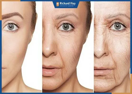 Các dấu hiệu da bị lão hóa Các dấu hiệu da bị lão hóa
