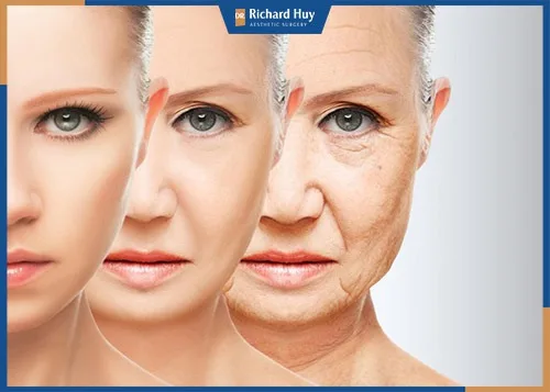 Quá trình lão hóa khiến mỡ tích tụ lại ở bọng mắt