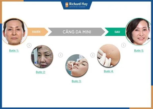 Quy trình phẫu thuật khép kín và công khai minh bạch Quy trình phẫu thuật khép kín và công khai minh bạch