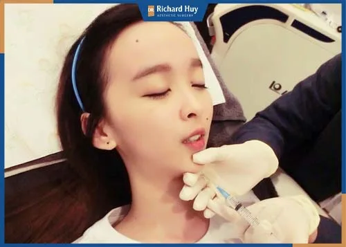 Tiêm Filler nhanh chóng, khắc phục tình trạng cằm lẹm trong 30 phút