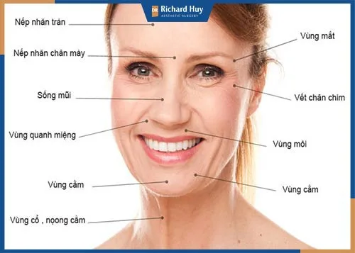 Dấu hiệu của làn da bị lão hóa Dấu hiệu của làn da bị lão hóa