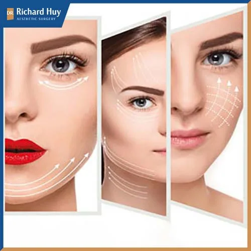 Căng da mặt nội soi được sử dụng rộng rãi giúp làm trẻ hóa gương mặt, kéo lại tuổi thanh xuân đã đánh mất Căng da mặt nội soi được sử dụng rộng rãi giúp làm trẻ hóa gương mặt, kéo lại tuổi thanh xuân đã đánh mất