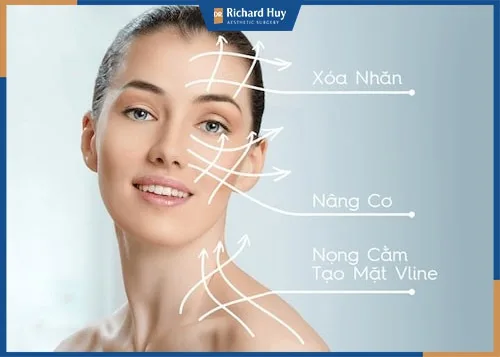 Có nên thẩm mỹ nâng cơ mặt hay không?