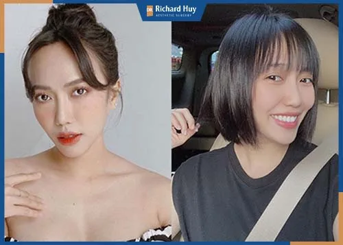 Diễn viên Diệu Nhi được nhiều người yêu mến cũng sở hữu dáng trán cao Diễn viên Diệu Nhi được nhiều người yêu mến cũng sở hữu dáng trán cao