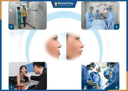 Quy trình phẫu thuật công khai minh bạch Quy trình phẫu thuật công khai minh bạch