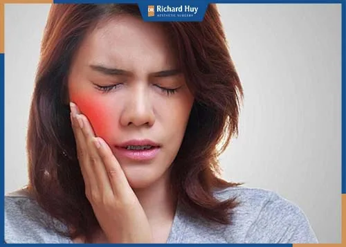 Biểu hiện này chủ yếu do kỹ thuật của bác sĩ, khi tiêm không may tác động tới các mao mạch máu dưới da mặt Biểu hiện này chủ yếu do kỹ thuật của bác sĩ, khi tiêm không may tác động tới các mao mạch máu dưới da mặt