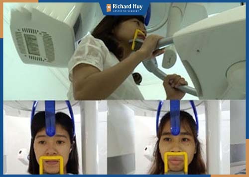Thiết bị máy chụp CT Scanner xác định chính xác tỷ lệ xương cần cần can thiệp để cân đối với gương mặt 