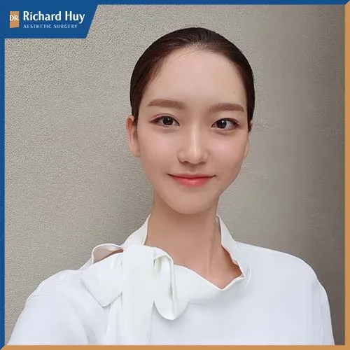 Trán cao là đẹp hay xấu là do cách nhìn nhận của mỗi người, nhưng đường nét trên gương mặt cần có sự hài hòa Trán cao là đẹp hay xấu là do cách nhìn nhận của mỗi người, nhưng đường nét trên gương mặt cần có sự hài hòa