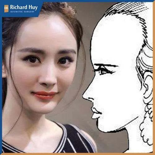 Nếu chiều dài từ chân tóc tới lông mày vượt quá tỉ lệ 1/3 thì được gọi là trán cao Nếu chiều dài từ chân tóc tới lông mày vượt quá tỉ lệ 1/3 thì được gọi là trán cao