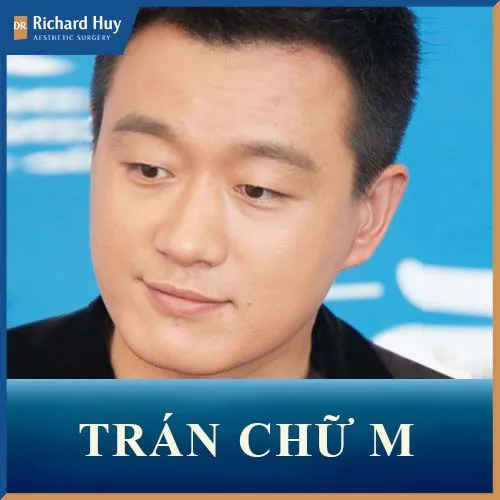 Trán chữ M hay còn gọi là trán “nghệ sĩ” là vầng trán khi nhìn vào thấy phần đường viền chân tóc có hình giống chữ M Trán chữ M hay còn gọi là trán “nghệ sĩ” là vầng trán khi nhìn vào thấy phần đường viền chân tóc có hình giống chữ M