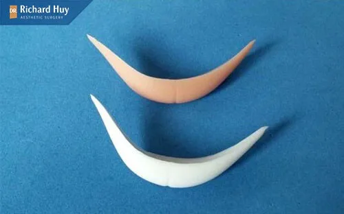 Có thể lắp miêng độn cằm mới ngay sau khi tháo bỏ Có thể lắp miêng độn cằm mới ngay sau khi tháo bỏ