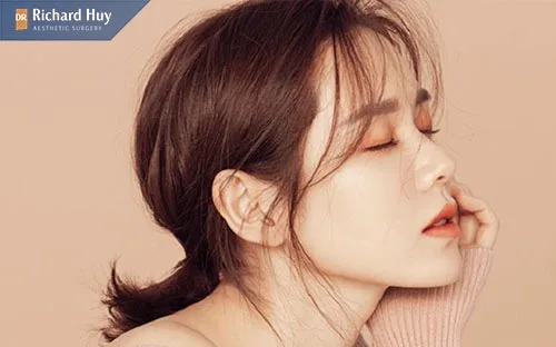 Thay đổi dáng mũi vĩnh viễn