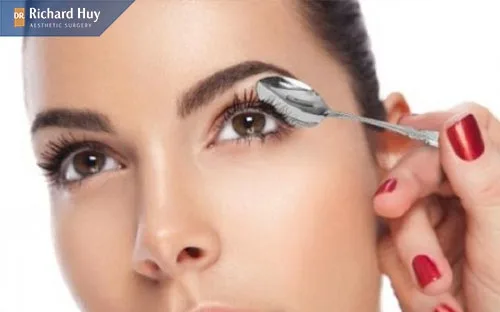 Sử dụng thìa để làm mặt Vline ở mắt