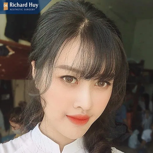 Móm miệng gây những nguy hiểm gì Móm miệng gây những nguy hiểm gì