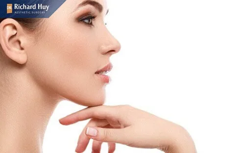 Tháo miếng độn cằm sẽ hồi phục sau 6 đến 7 ngày Tháo miếng độn cằm sẽ hồi phục sau 6 đến 7 ngày