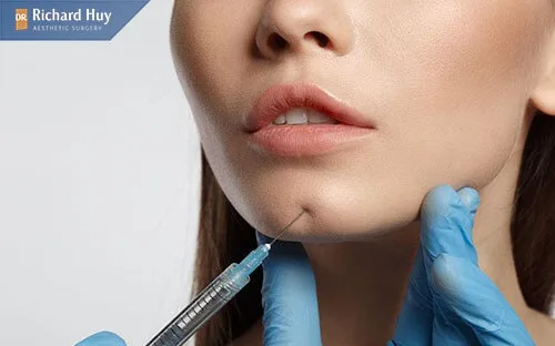 Tiêm filler khiến cằm bị sưng Tiêm filler khiến cằm bị sưng
