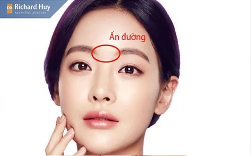 Chăm sóc, bảo vệ da như thế nào sau khi xóa nếp nhăn ấn đường Chăm sóc, bảo vệ da như thế nào sau khi xóa nếp nhăn ấn đường