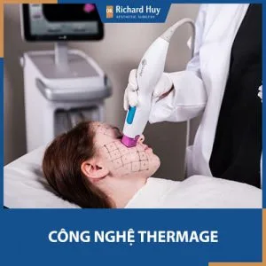 Muốn căng da bằng Thermage Nhất Định phải biết sự thật này !