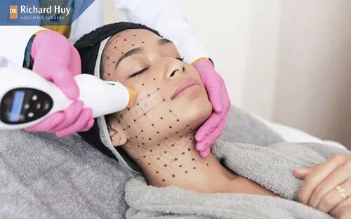 Công nghệ Thermage an toàn không gây hại cho cơ thể Công nghệ Thermage an toàn không gây hại cho cơ thể