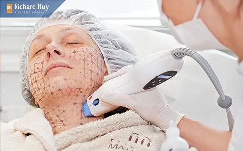 Xóa nếp nhăn vùng cổ bằng công nghệ Thermage Xóa nếp nhăn vùng cổ bằng công nghệ Thermage