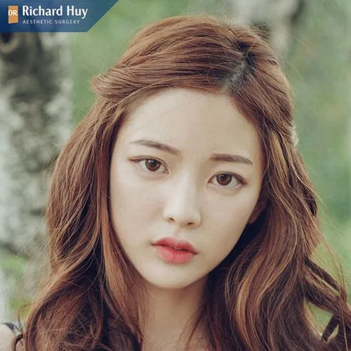 Đường tình duyên của người có mũi lệch Đường tình duyên của người có mũi lệch