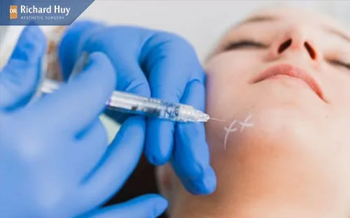 Kỹ thuật bác sĩ thực hiện cũng là nguyên nhân gây thâm cằm