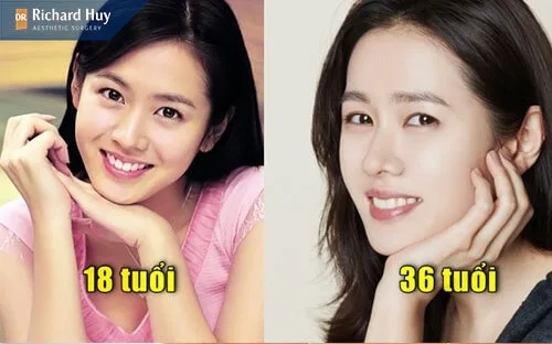 SON YE JIN 36 tuổi vẫn đẹp trẻ trung như 18 tuổi SON YE JIN 36 tuổi vẫn đẹp trẻ trung như 18 tuổi
