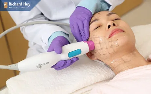 Bí quyết đảo ngược lão hóa với phương pháp Thermage FLX Bí quyết đảo ngược lão hóa với phương pháp Thermage FLX