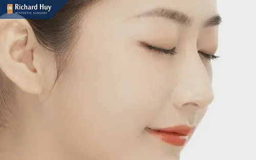 Nâng mũi bán cấu trúc tạo dáng mũi tự nhiên Nâng mũi bán cấu trúc tạo dáng mũi tự nhiên