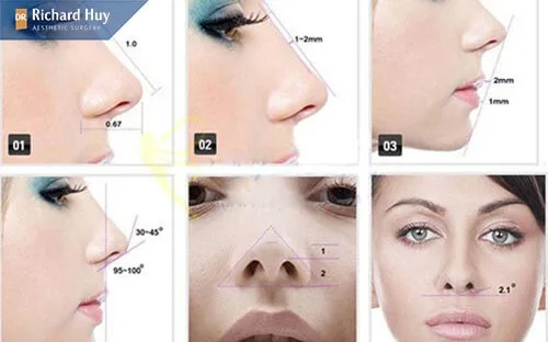 Quy trình thực hiện nâng mũi bán cấu trúc Quy trình thực hiện nâng mũi bán cấu trúc