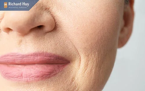 Tại sao lại có khóe miệng suất hiện nếp nhăn Tại sao lại có khóe miệng suất hiện nếp nhăn