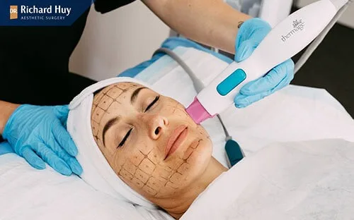 Cách hoạt động của công nghệ Thermage FLX Cách hoạt động của công nghệ Thermage FLX