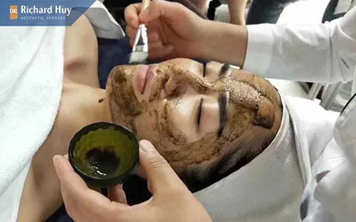 Quy trình thực hiện của phương pháp vi kim tảo biển
