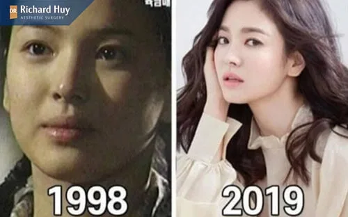 Lão hóa ngược từ năm 1998-2019 làm nhiều người ghen tị Lão hóa ngược từ năm 1998-2019 làm nhiều người ghen tị