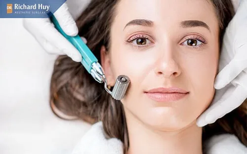 Tái tạo lại làn da đẹp như với phương pháp lăn kim Tái tạo lại làn da đẹp như với phương pháp lăn kim