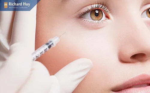 Khắc phục triệt để vết chân chim trên mắt bằng cách tiêm botox