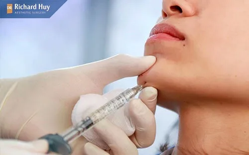 Tiêm cằm bao nhiêu cc là vửa đủ và đẹp tự nhiên Tiêm cằm bao nhiêu cc là vửa đủ và đẹp tự nhiên