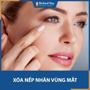 Tổng hợp các cách xóa nếp nhăn vùng mắt hiệu quả khiến bạn ngờ bất ngờ