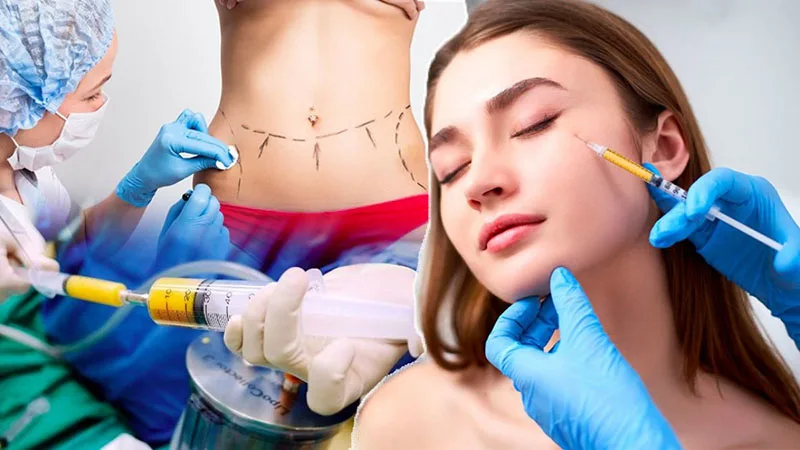 Cấy mỡ khuôn mặt lấp đầy má hóp, làm đầy rãnh mũi má…